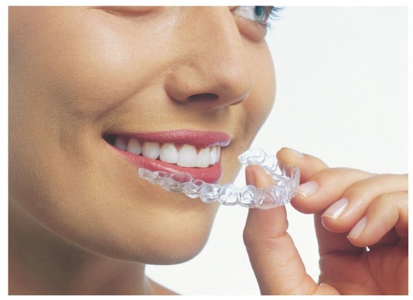 What You Should Know Before Starting Invisalign #InvisalignMom